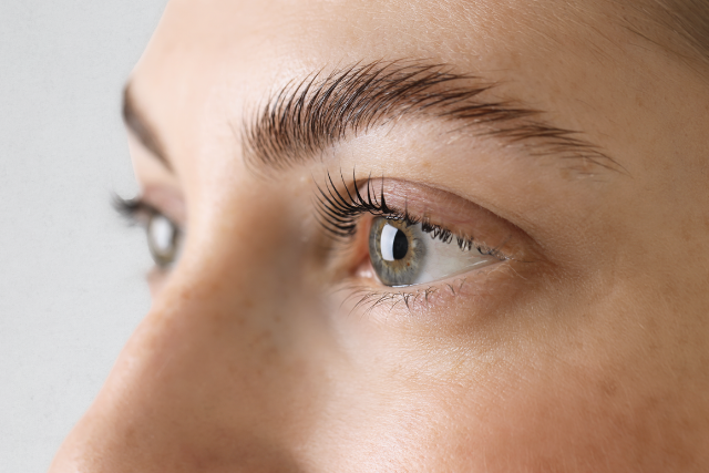 Under Eye Lift